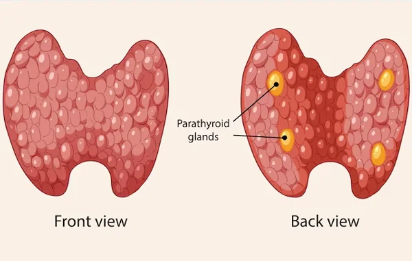 Parathyroid Surgeries