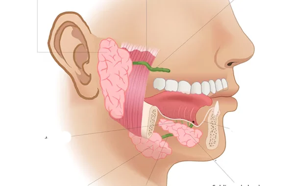 Other Salivary Gland Tumors